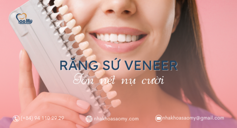 Răng sứ veneer
