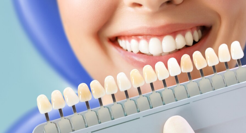 Sao Mỹ bảo tồn răng thật