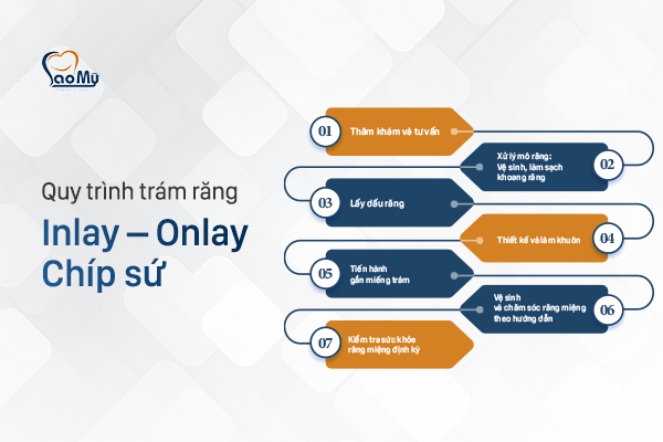 Quy trình trám răng công nghệ