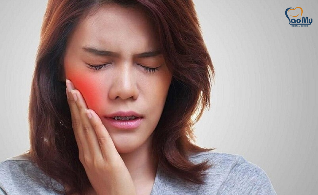lấy tủy răng xong vẫn sưng