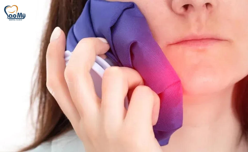 lấy tủy răng xong bị sưng